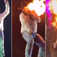 Impressionante! Cantor mostra como ficou o rosto após pegar fogo durante show