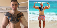 Influencer conhecido como 'Popeye Russo' é hospitalizado para 'retirar bíceps' Foto: Reprodução/Instagram